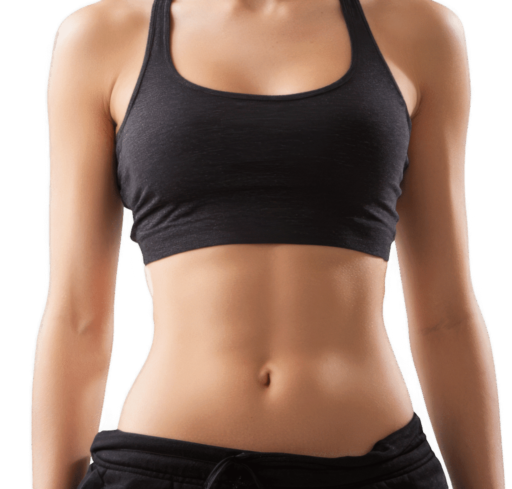 Emsculpt NEO for Diastasis Recti at Pollard Preventative in Los Gatos After pic