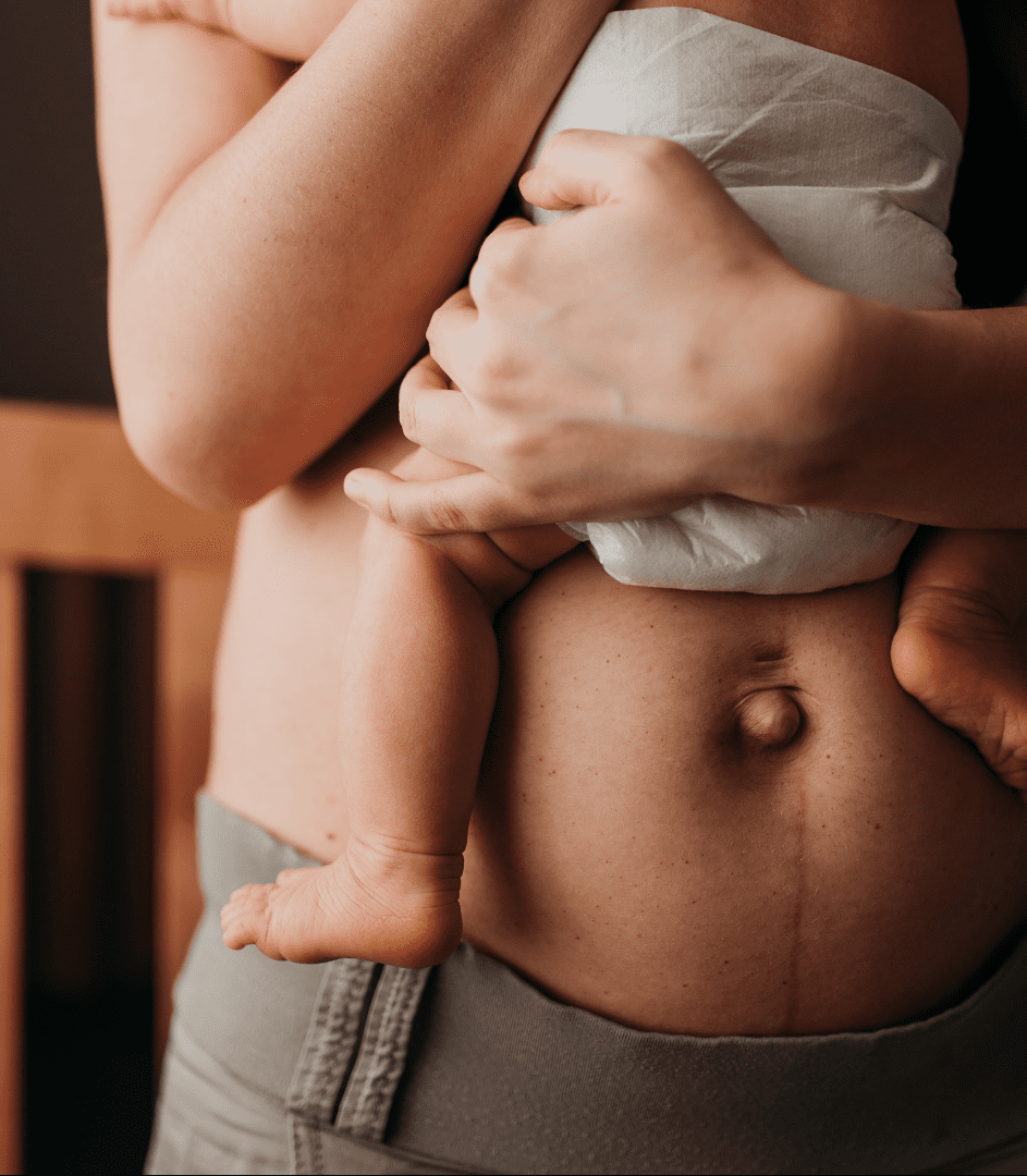 Postpartum Recovery Mommy Makeover at Pollard Preventative in Los Gatos