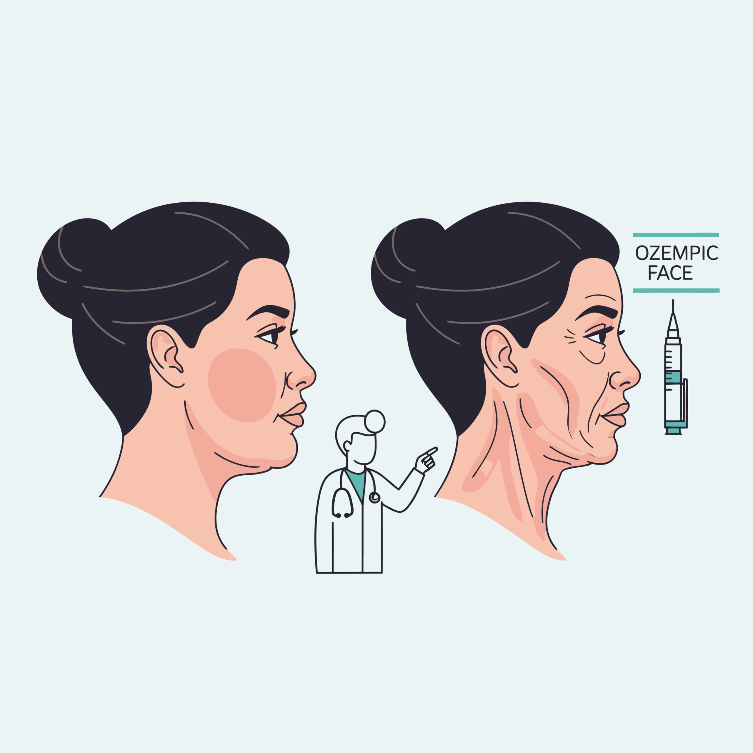 Emface + Exion Treatment for Ozempic Face at Pollard Preventative in Los Gatos Infographic pic