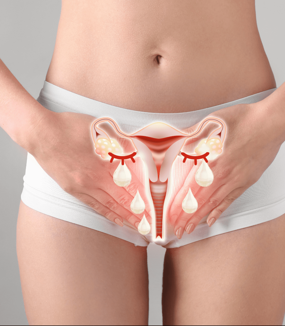 Emfemme for vaginal dryness and discomfort at Pollard Preventative in Los Gatos